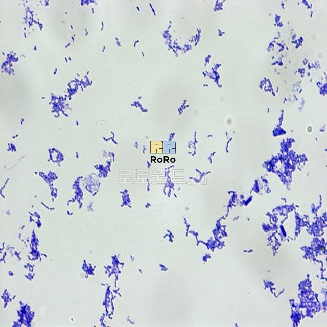 연쇄상구균 (Streptococcus) 슬라이드 프레파라트